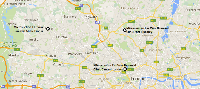 Microsuction in London NW1, N2, NW7, NW11, W13, HA5 and IG10 From £50 Microsuction in London NW1, N2, NW7, NW11, W13, HA5 and IG10 From £50